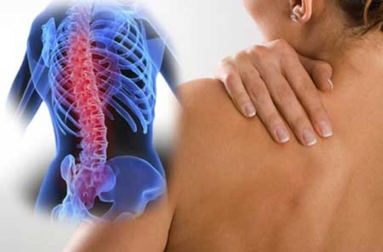 Durante unha exacerbación da osteocondrose da columna vertebral torácica, prodúcese dor dorsal