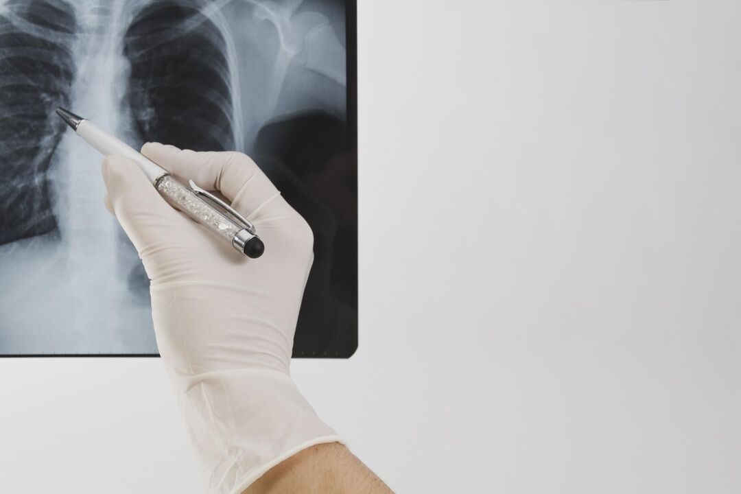 Radiografía para diagnosticar osteocondrose